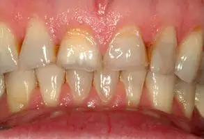 Granite View Dental Granite View Dental